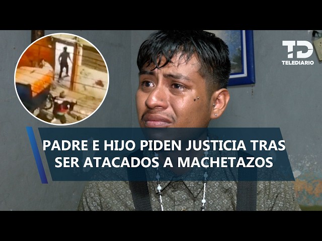 "I'm afraid": José Alejandrino asks for justice after being attacked with machetes in Ecatepec