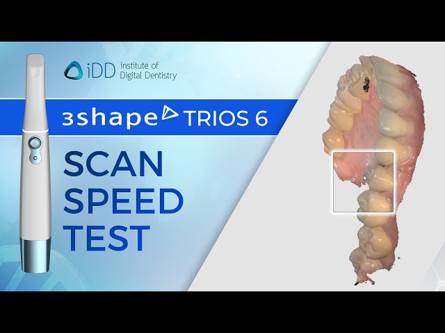 3Shape TRIOS 6 Intraoral Scanner Speed Test | iDD