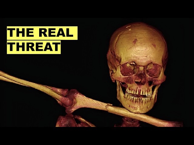 Ötzi the Iceman Had Bigger Problems Than an Arrow