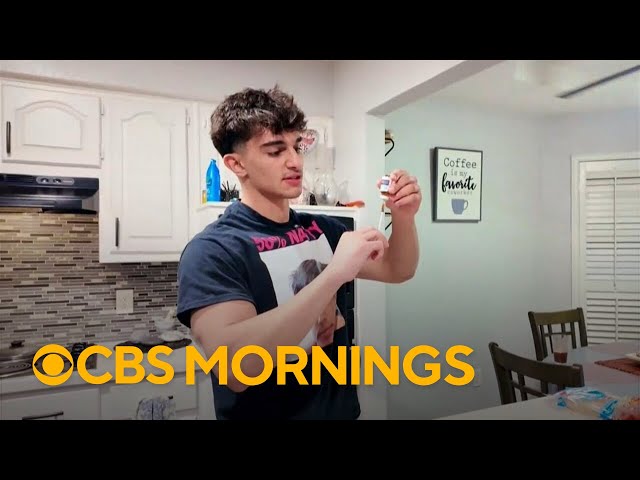 Teen says social media trend convinced him to take dangerous steroids