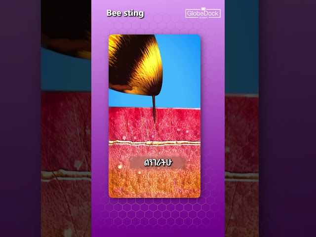 What Really Happens When a Bee Stings You 🐝 | Science Explained - Globedock Academy