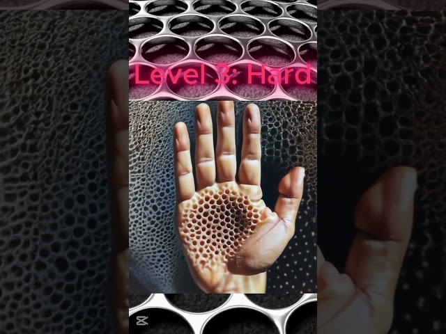 Trypophobie #gruselig #Phobie #Test #Englisch